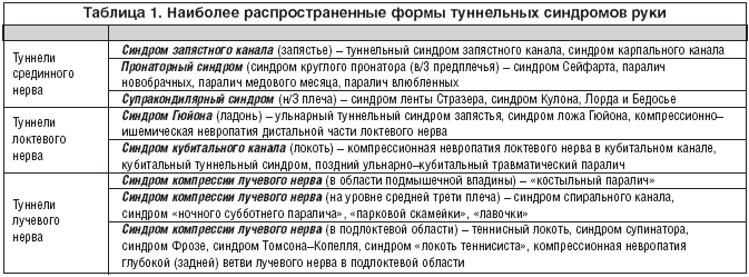 Виды туннельных синдромов руки